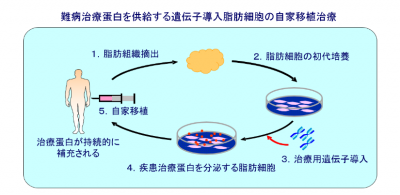 遺伝子治療